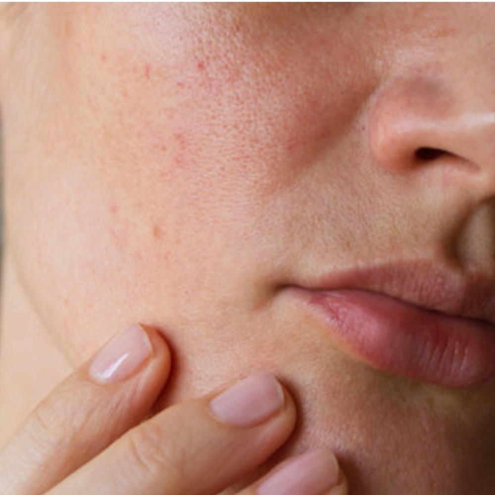 skincare-for-dullness